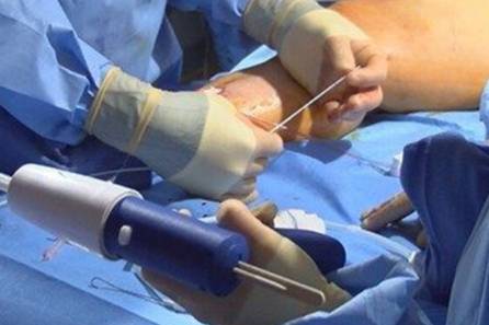 Glutathione Injections