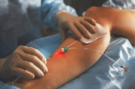 Glutathione Injections