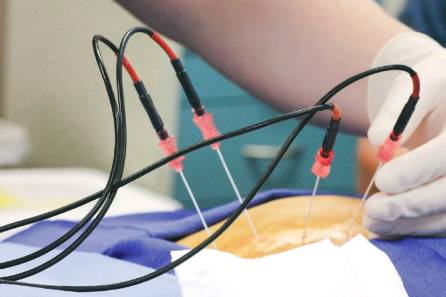Laser Skin Brightening