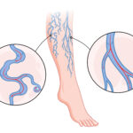 vascular surgeon in hyderabad