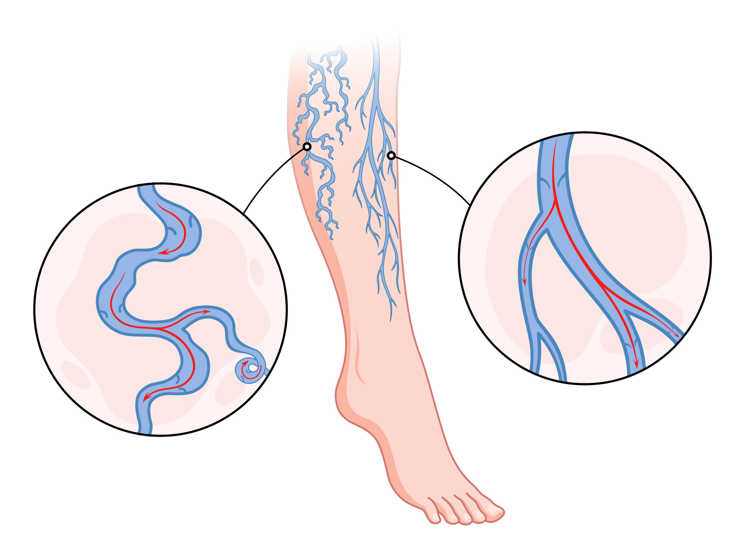 vascular surgeon in hyderabad