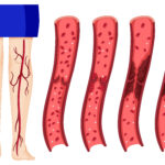 Best Vascular Surgeon Near Me