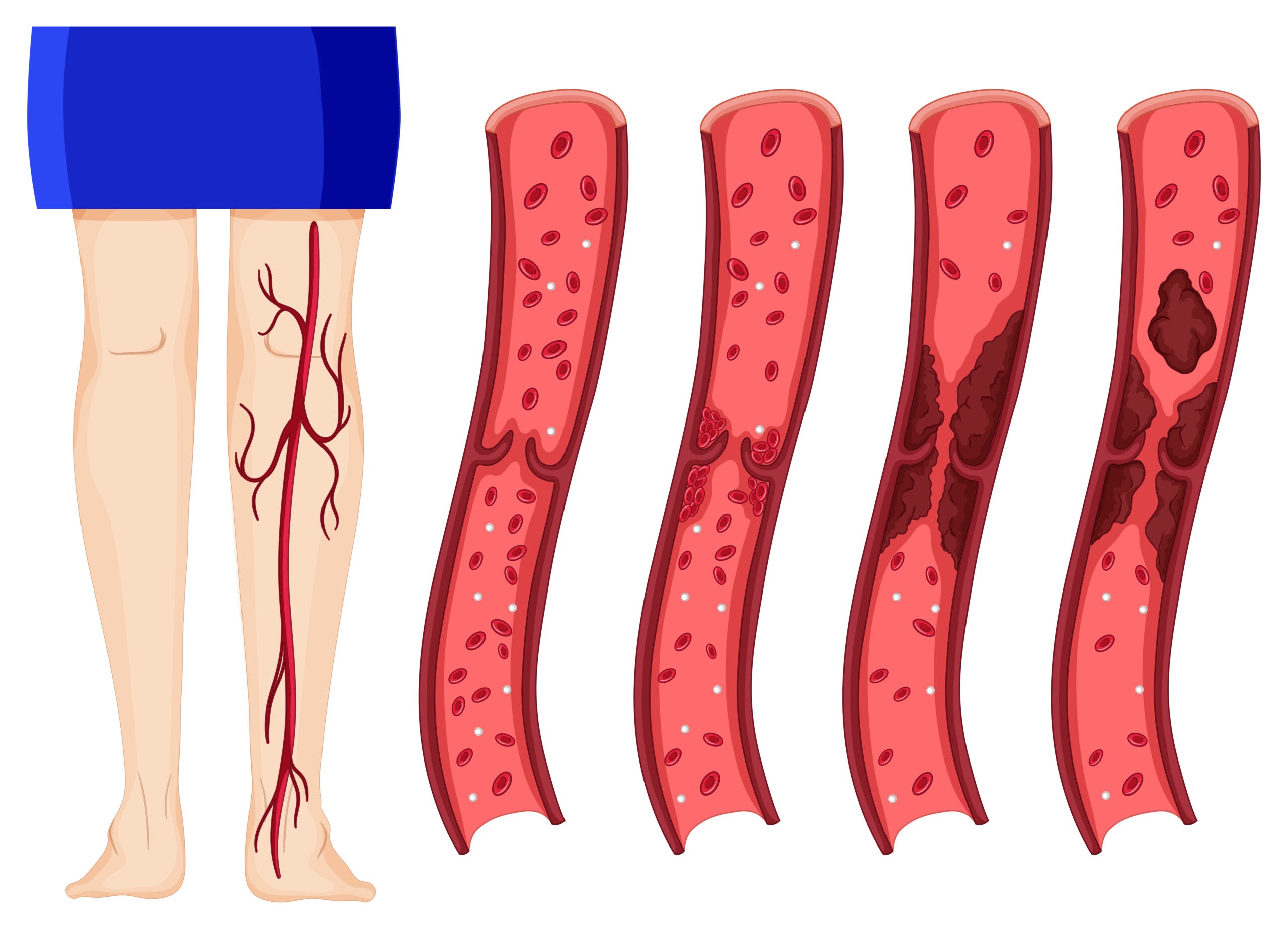 Best Vascular Surgeon Near Me