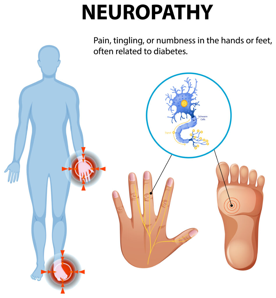 peripheral neuropathy doctors near me