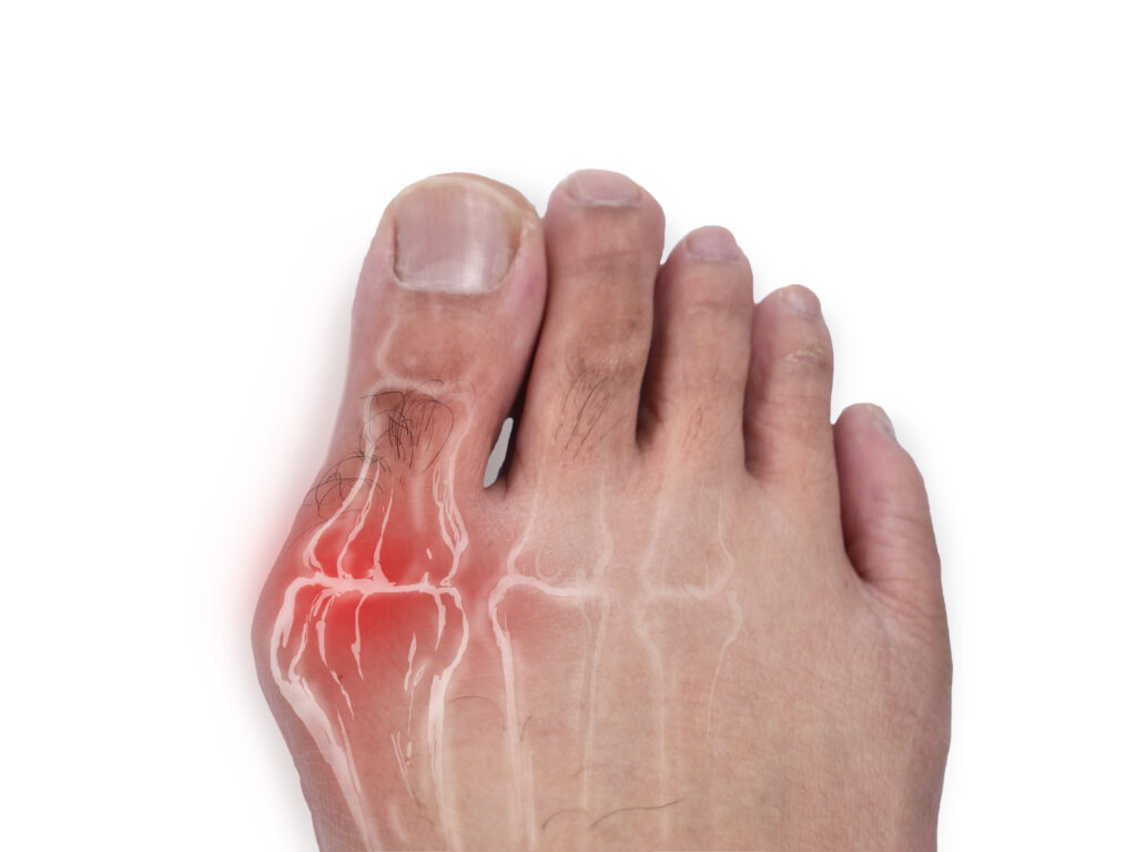 approach to peripheral neuropathy