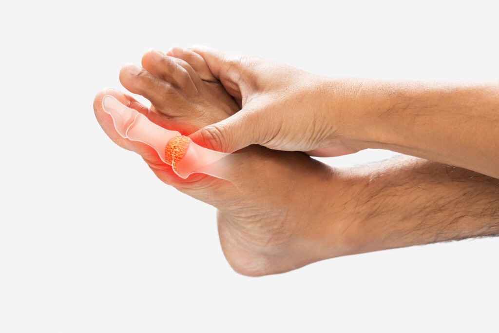 peripheral neuropathy doctors