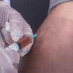 Vascular Surgeon in Medchal