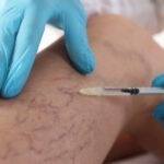 Vascular Surgeon in Tirupati