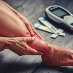 podiatrist Hyderabad