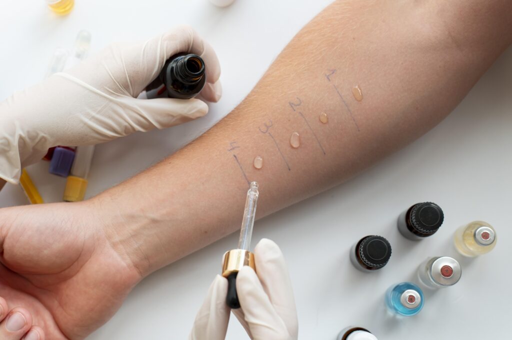 laser treatment for varicose veins – procedure, benefits & recovery