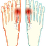 Foot Pain Doctor Near Me