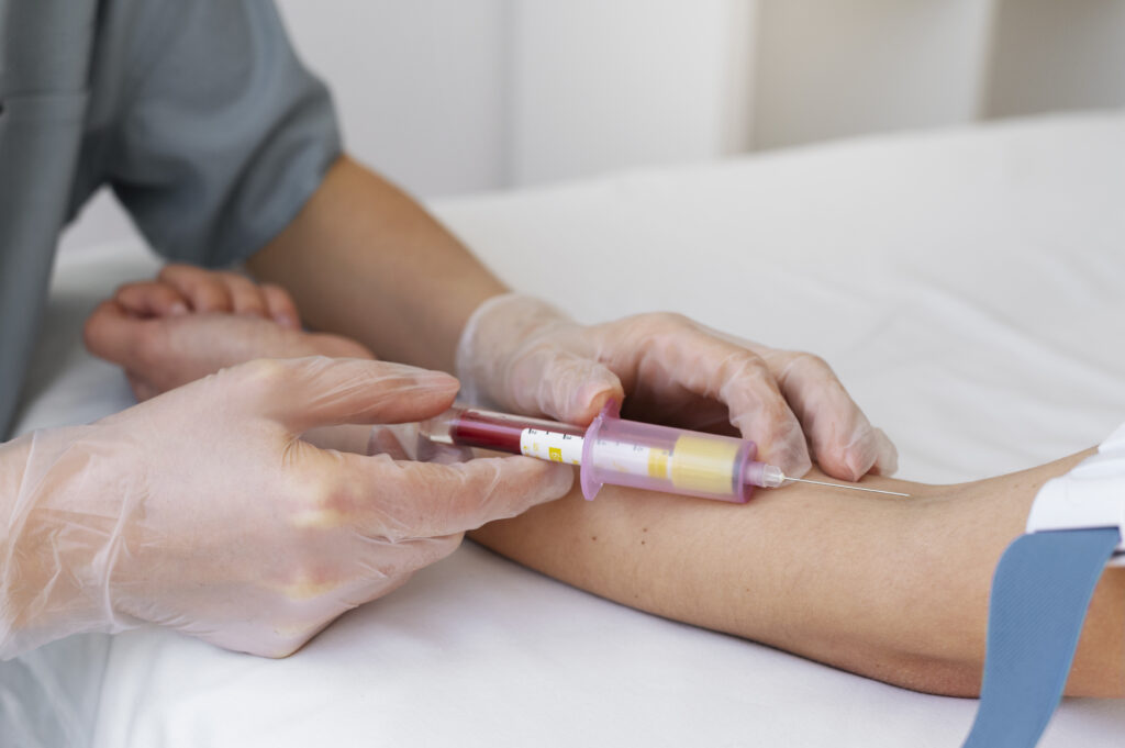 varicose veins Doppler test – purpose, price, and preparation