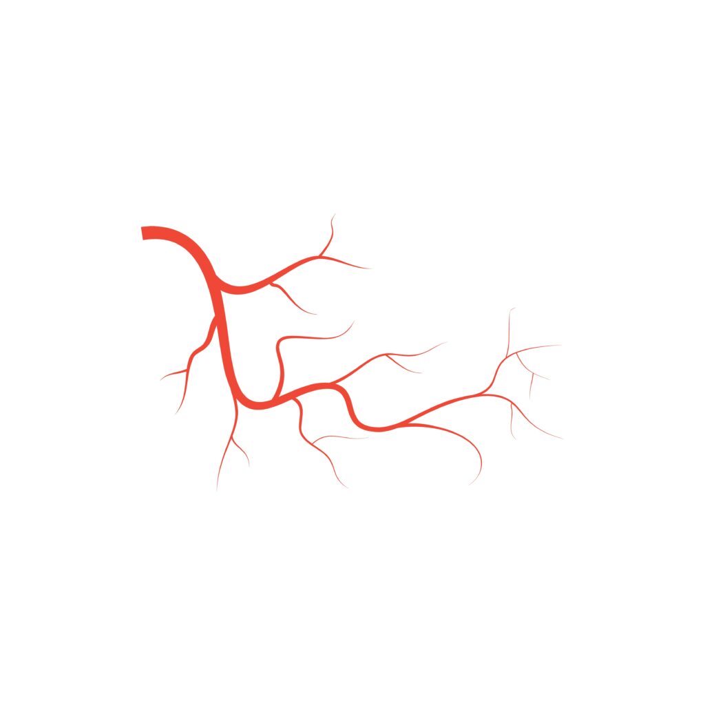 vascular surgeon in hyderabad