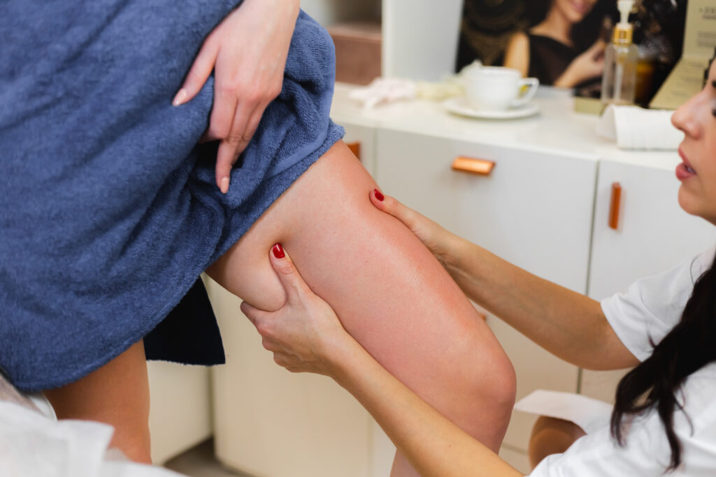 best vascular hospital in hyderabad varicose veins treatment in hyderabad
