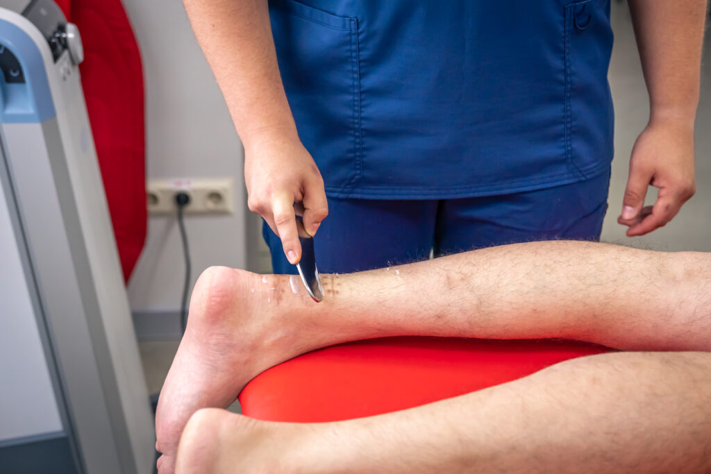 Varicose Veins Specialist in Hyderabad