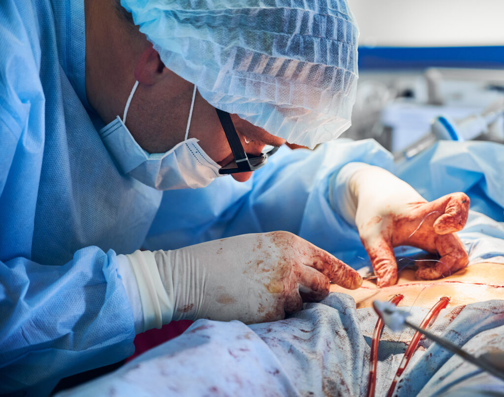 Vascular Surgery in Hyderabad