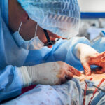 Vascular Surgery in Hyderabad