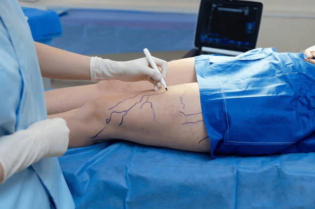 Types of Vascular Surgery