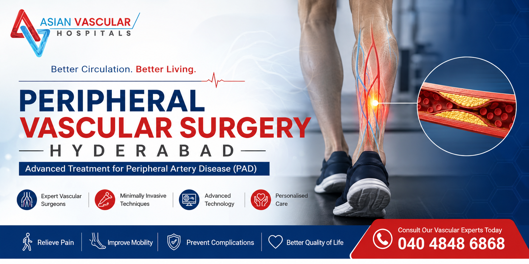 eripheral Vascular Surgery Hyderabad