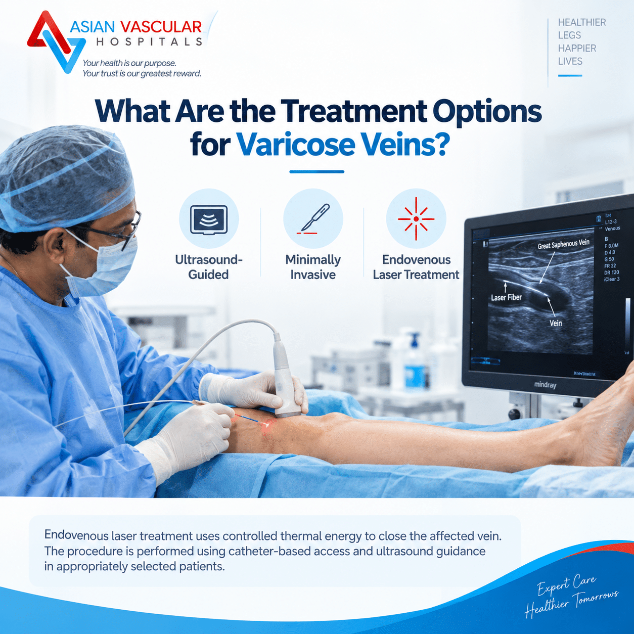 Specialist performing ultrasound-guided minimally invasive laser varicose veins treatment in Hyderabad.