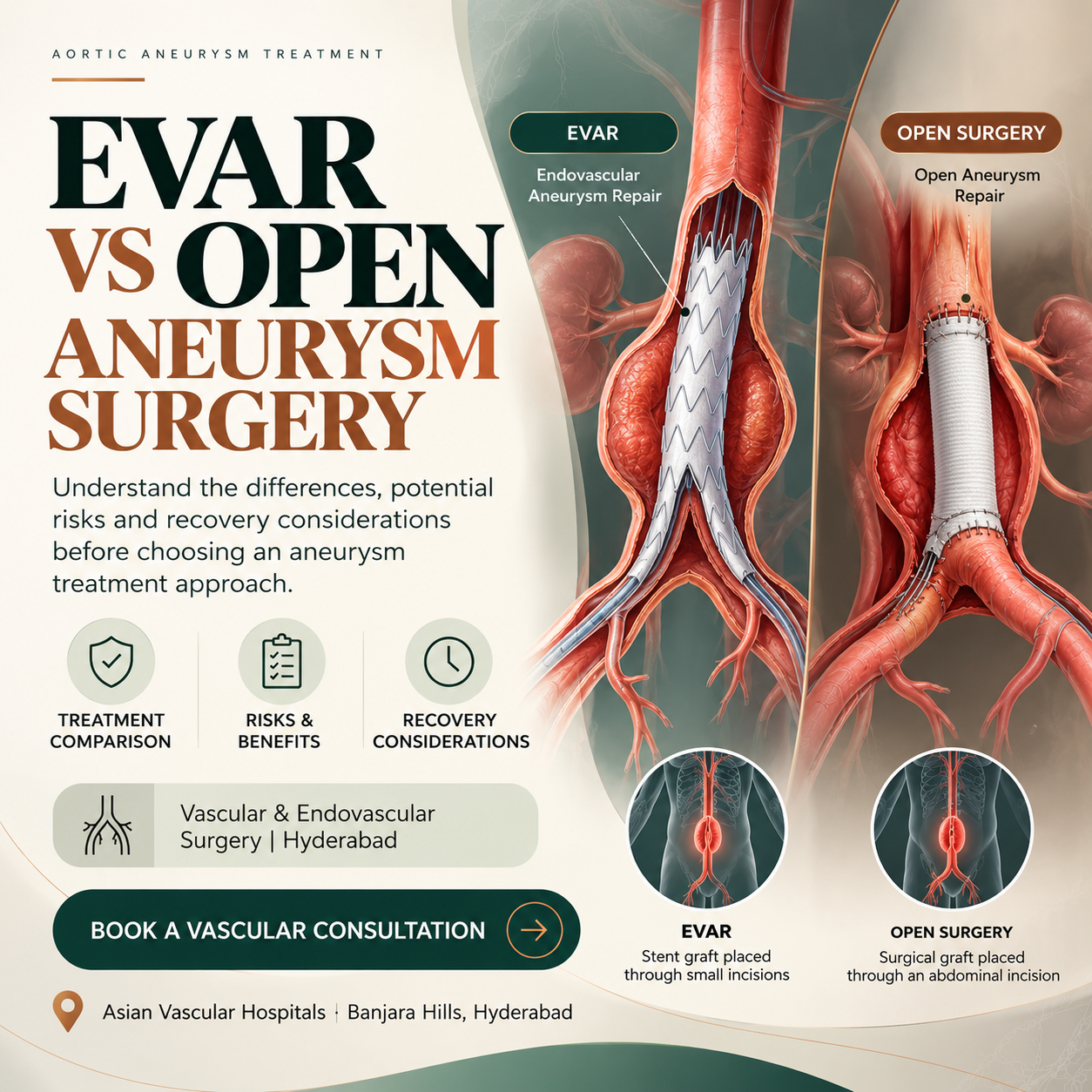 Medical illustration comparing EVAR stent graft placement with open aortic aneurysm repair at Asian Vascular Hospitals in Hyderabad.