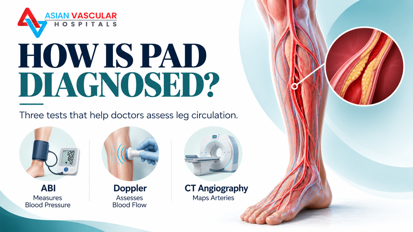 Medical illustration introducing ABI, Doppler ultrasound and CT angiography as tests used to investigate peripheral artery disease.