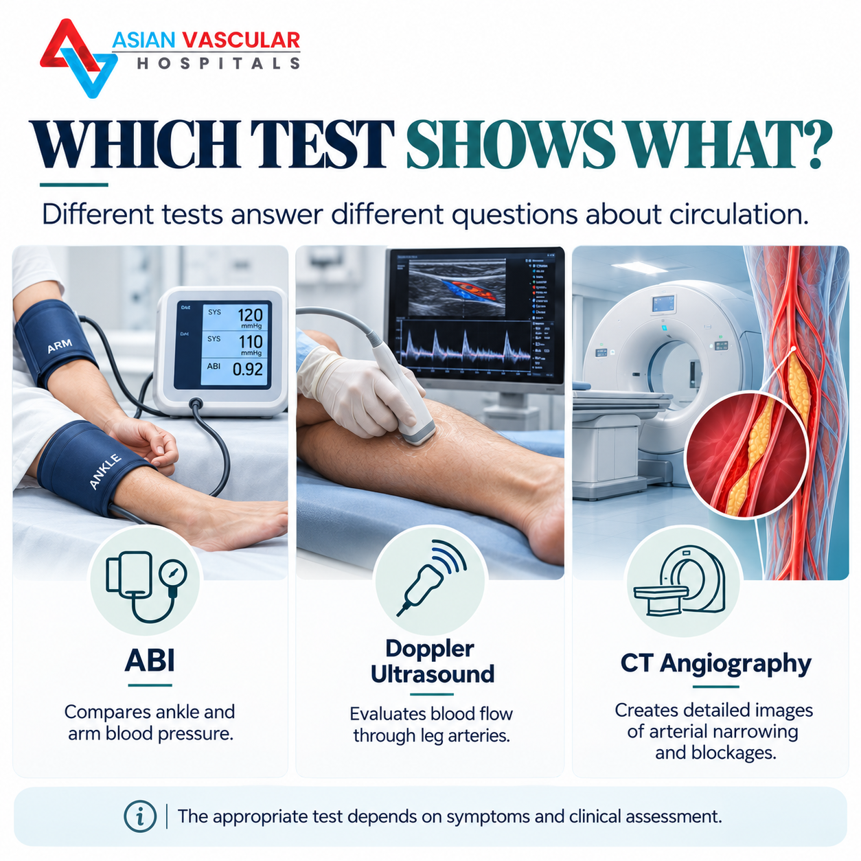 Comparison infographic explaining what ABI, Doppler ultrasound and CT angiography evaluate during peripheral artery disease diagnosis.